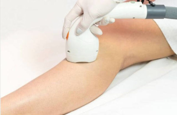 Laser Hair Removal Joplin Laser Hair Removal Joplin