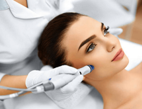 How Does Microdermabrasion Benefit My Skin?