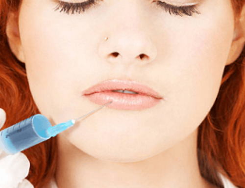 The 411 on Non-Surgical Lip Augmentation