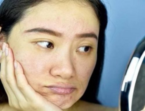 How Much Does Dermaplaning Cost?